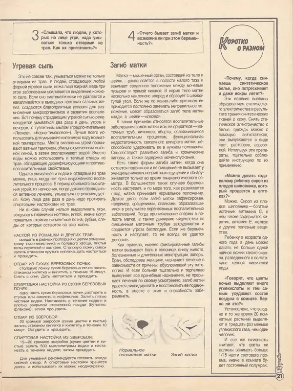  Журнал «Здоровье» - Здоровье 1985 №02 - Страница № 27