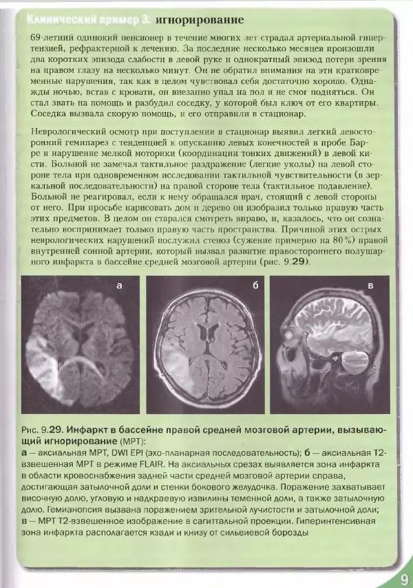 Коллектив авторов - Топический диагноз в неврологии по Петеру Дуусу - Страница № 467 Коллектив авторов - Топический диагноз в неврологии по Петеру Дуусу - Страница № 467