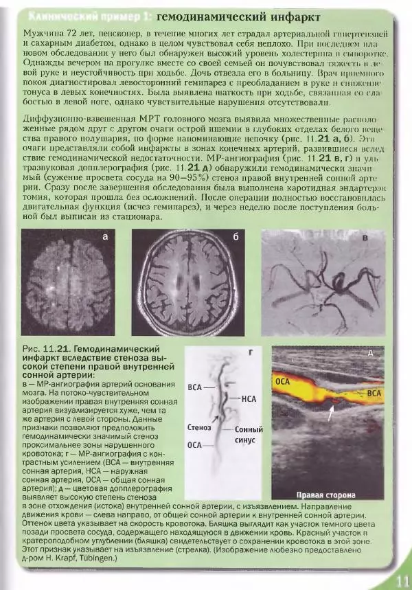 Коллектив авторов - Топический диагноз в неврологии по Петеру Дуусу - Страница № 524 Коллектив авторов - Топический диагноз в неврологии по Петеру Дуусу - Страница № 524