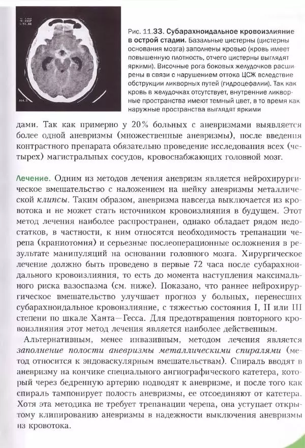 Коллектив авторов - Топический диагноз в неврологии по Петеру Дуусу - Страница № 566 Коллектив авторов - Топический диагноз в неврологии по Петеру Дуусу - Страница № 566
