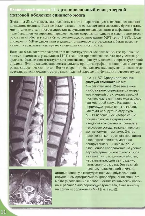 Коллектив авторов - Топический диагноз в неврологии по Петеру Дуусу - Страница № 575 Коллектив авторов - Топический диагноз в неврологии по Петеру Дуусу - Страница № 575